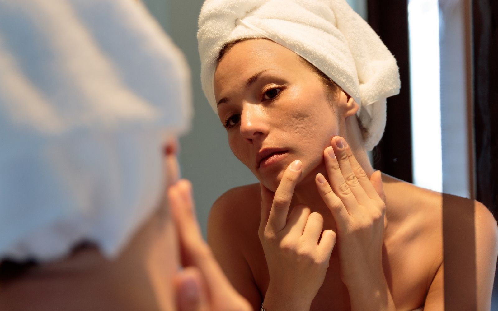An essential guide to adult acne | Zooki