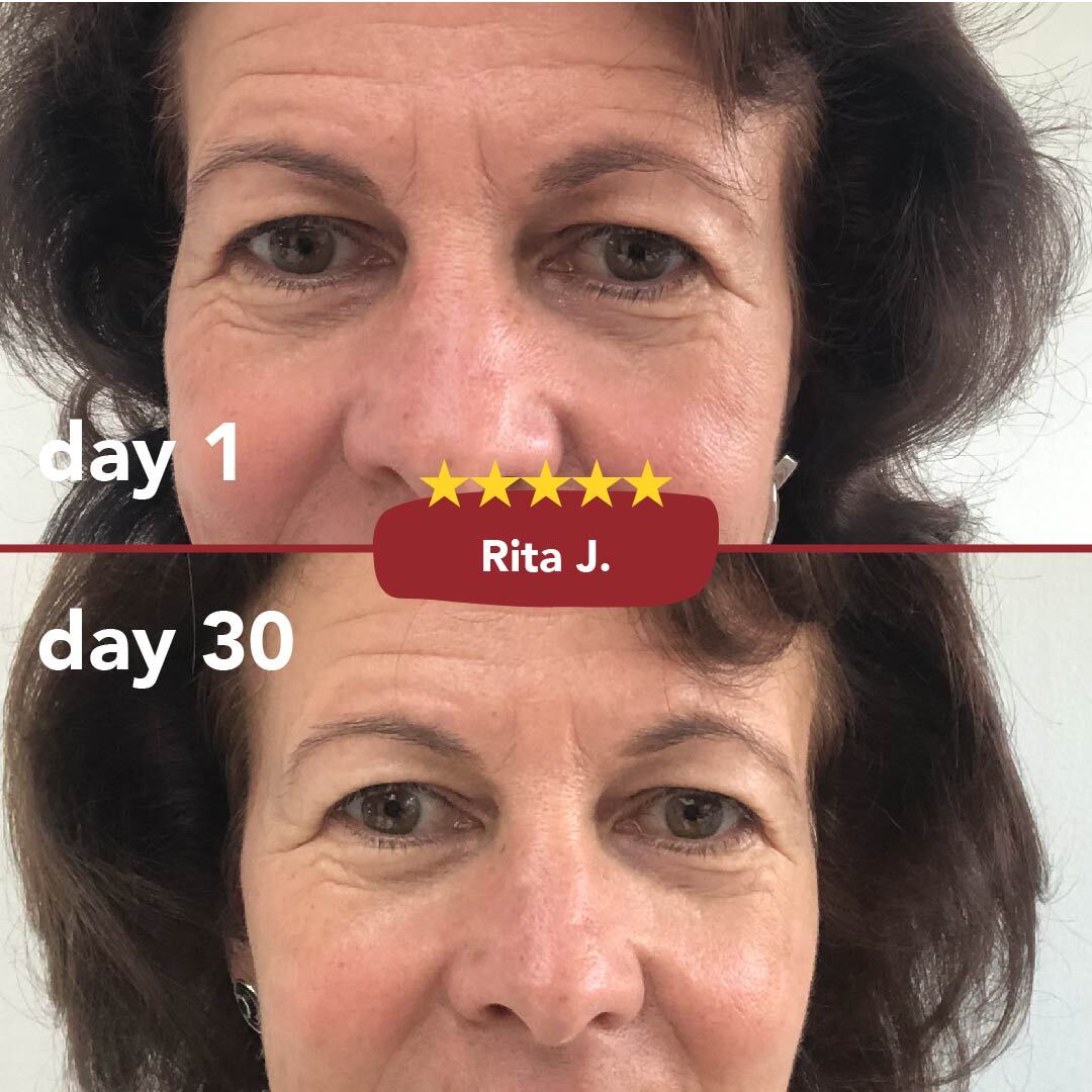 Zooki Collagen Before & After Photos - Skin, Hair & Nails