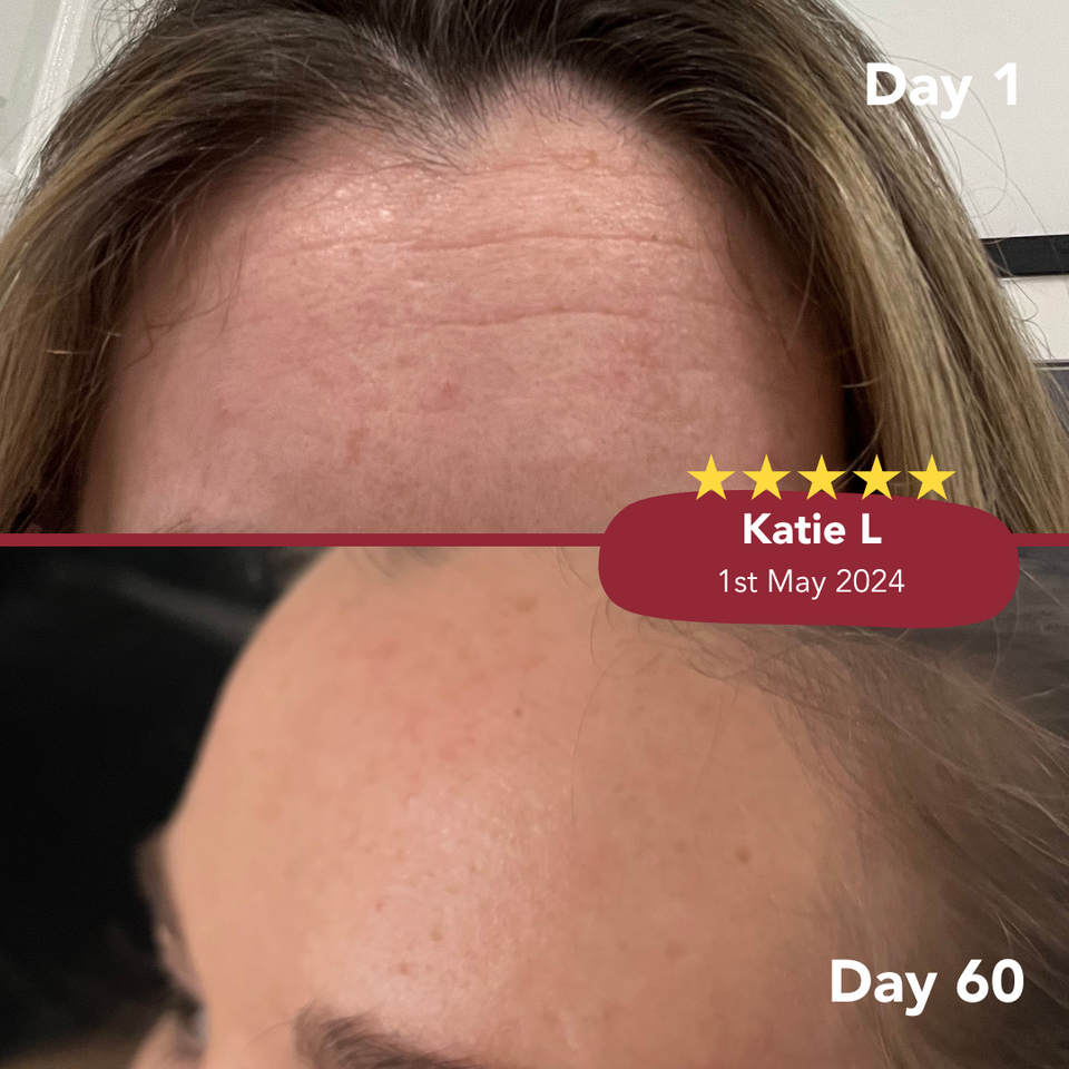 Zooki Collagen Before & After Photos - Skin, Hair & Nails